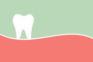 曲線を描く歯茎と歯のイラスト