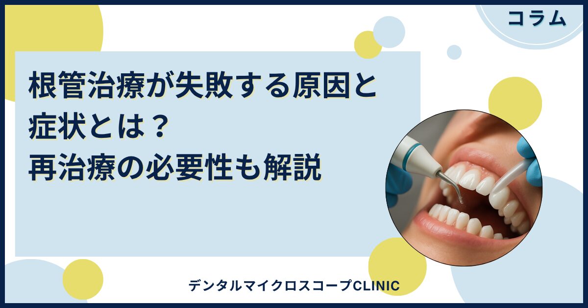 歯内療法失敗回避のためのポイント47 : なぜ痛がるのか、なぜ治らないのか 歯内療法 失敗回避のためのポイント47 - クインテッセンス出版