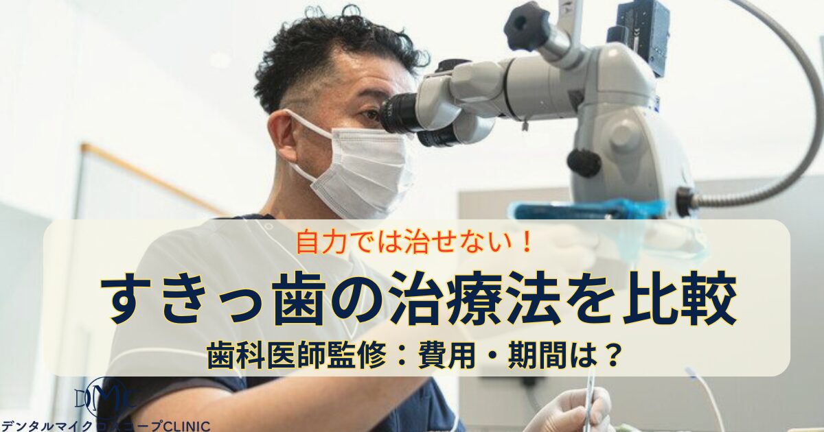 歯科医師監修｜すきっ歯の治療法6つの費用・期間比較！自力治癒は不可