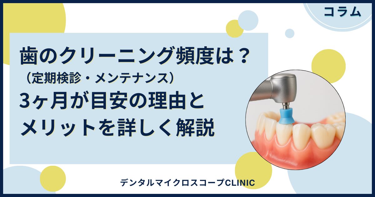 歯のクリーニング（定期検診・メンテナンス）頻度は？3ヶ月が目安の 