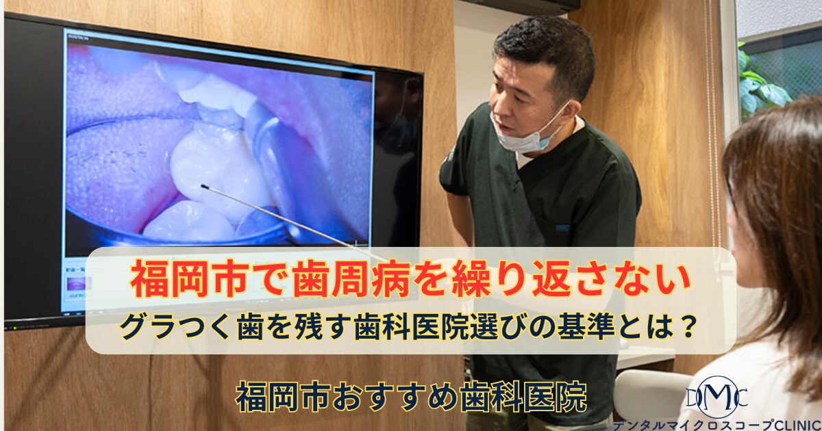 福岡市】歯周病を繰り返さない・グラつく歯を残す歯科医院選びの基準と