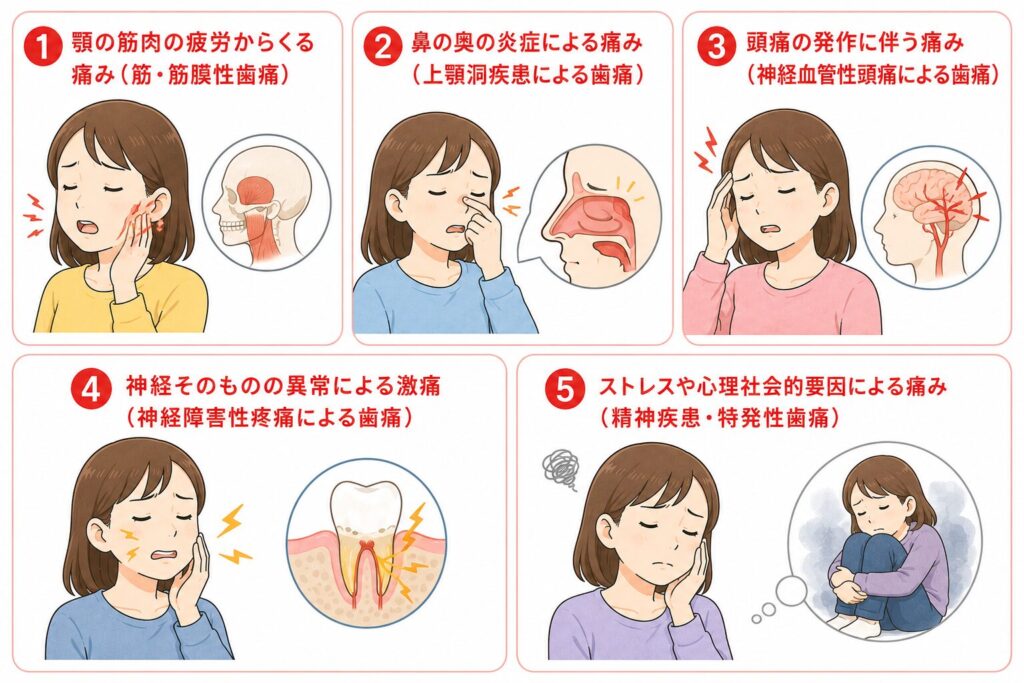 非原性歯痛による痛みのイラスト