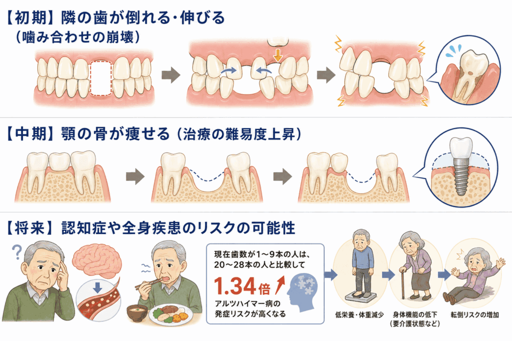 初期・中期・将来的に、歯がない状態が引き起こすリスクの図示