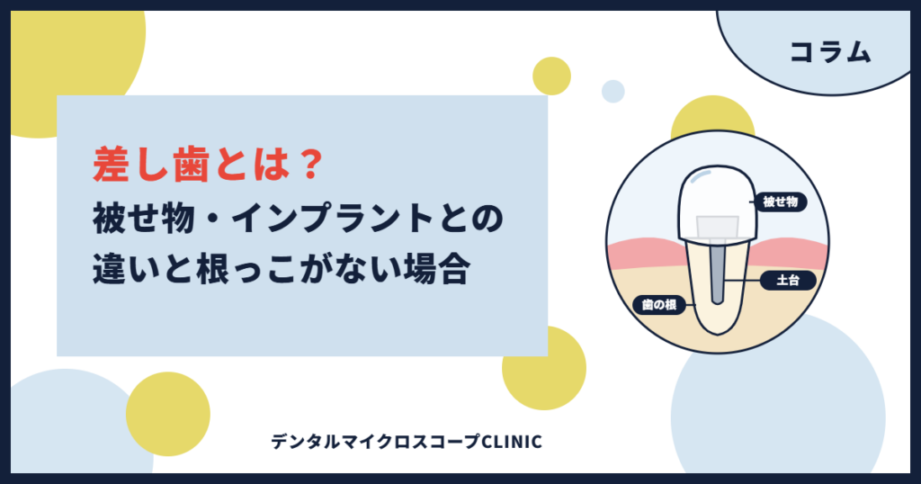 差し歯とは何かを解説するコラムのアイキャッチ。歯の根・土台・被せ物の3つでできた差し歯の断面イラスト